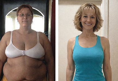 Sophia K. before and after